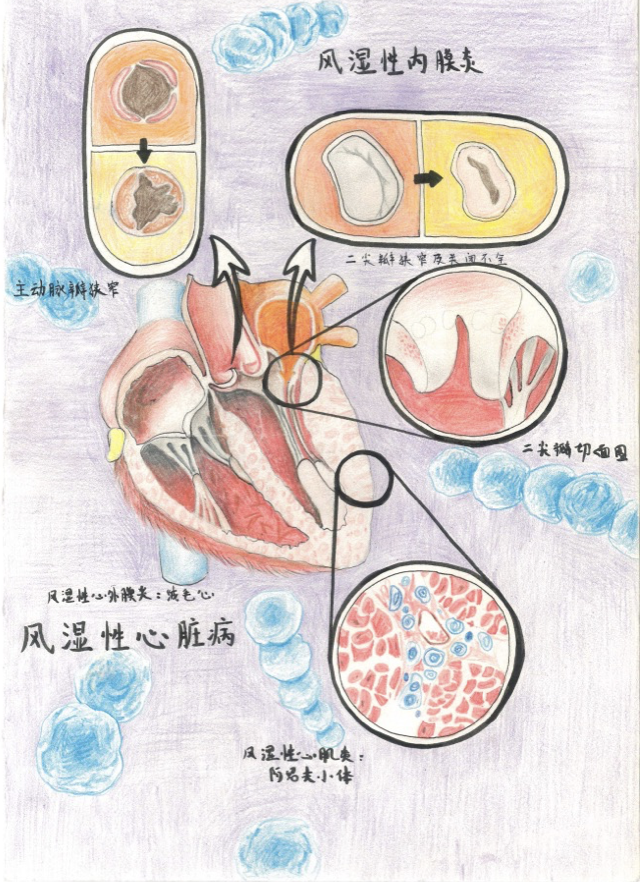 作品投票|医学与美术竟擦出火花?一起欣赏笔尖下的浪漫!