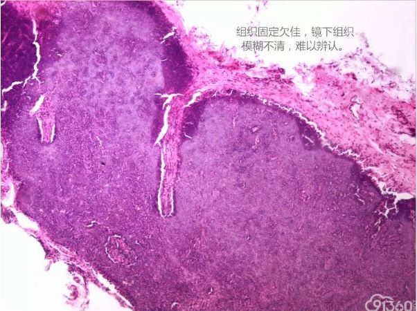 病理保存液有哪些标本组织固定液的选择和方法_https://www.jmylbn.com_新闻资讯_第1张
