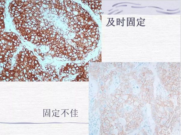 病理保存液有哪些标本组织固定液的选择和方法_https://www.jmylbn.com_新闻资讯_第2张