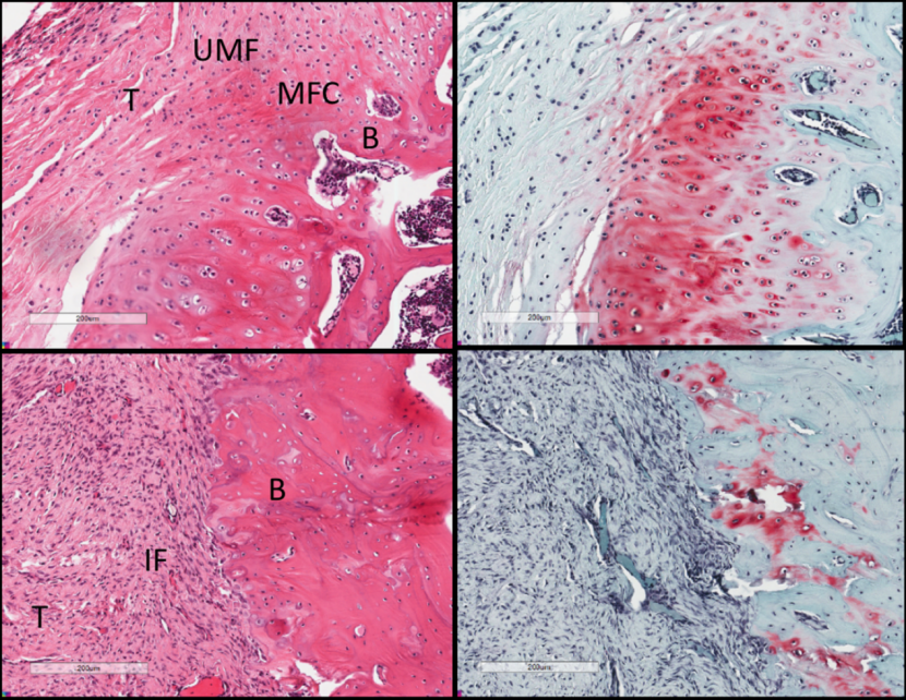 为什么会有单关节器械关节镜下肩袖修复：单排 vs 双排缝合，如何选择？_https://www.jmylbn.com_新闻资讯_第9张
