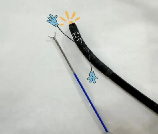 内镜夹怎么不掉一文带您了解内镜手术的 “止血小帮手”——金属夹_https://www.jmylbn.com_新闻资讯_第2张