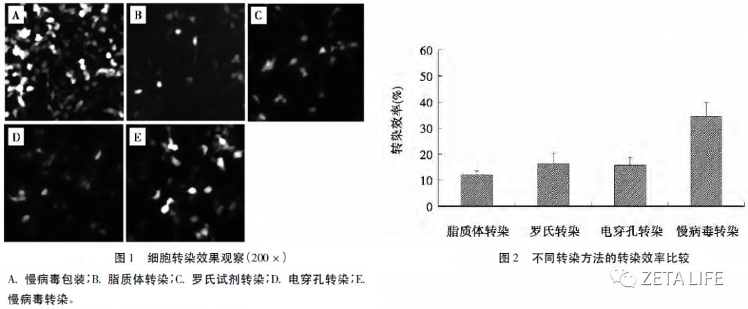 小鼠單核巨噬細(xì)胞白血病細(xì)胞（RAW264.7）的培養(yǎng)要點(diǎn)及高效轉(zhuǎn)染試劑