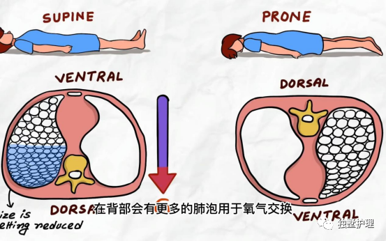 什么病忌用翻身床为什么危重患者有时候为什么要“趴着”？_https://www.jmylbn.com_新闻资讯_第3张