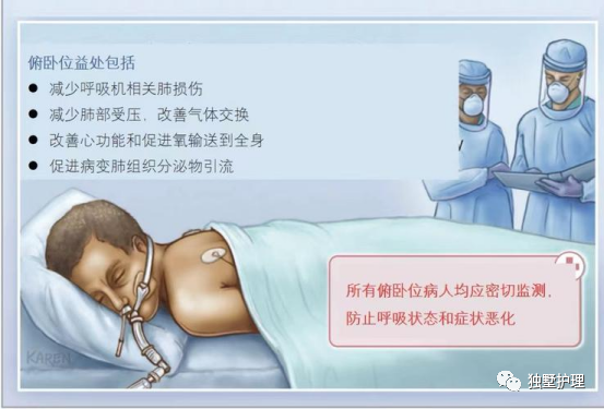 什么病忌用翻身床为什么危重患者有时候为什么要“趴着”？_https://www.jmylbn.com_新闻资讯_第4张