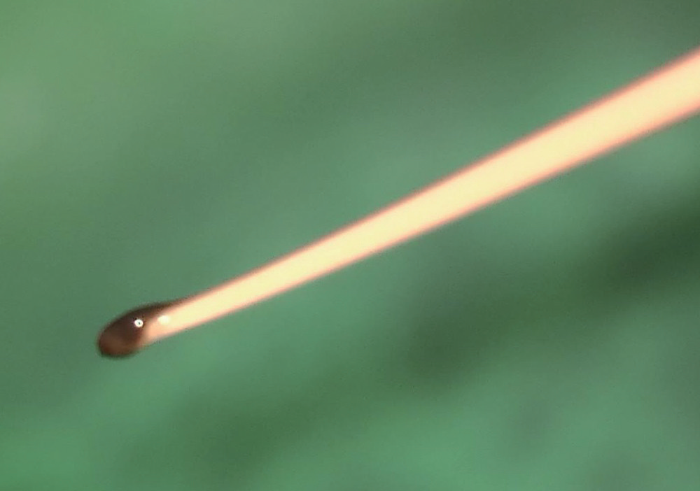 牙胶尖什么颜色MTA的临床应用——陈志平教授_https://www.jmylbn.com_新闻资讯_第8张