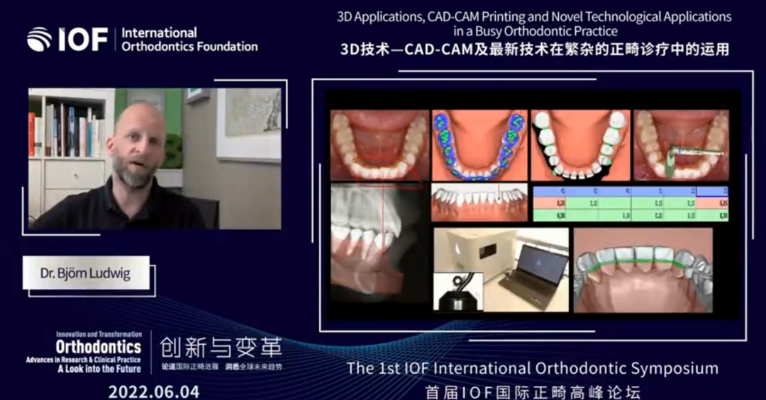 移动DR怎么推走吾辈新使命 ｜ 2022首届IOF国际正畸高峰论坛暨IOF国际正畸基金会全球发布大会回顾报道_https://www.jmylbn.com_新闻资讯_第10张