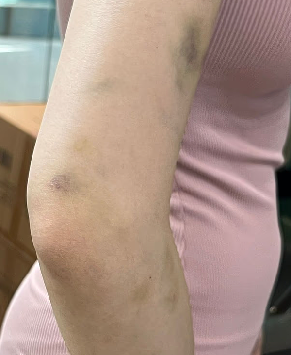 ����ϴ�ּ��������ִ��Ϥ�ỪŮ������Ϯ������������������������ͼ�� - 8