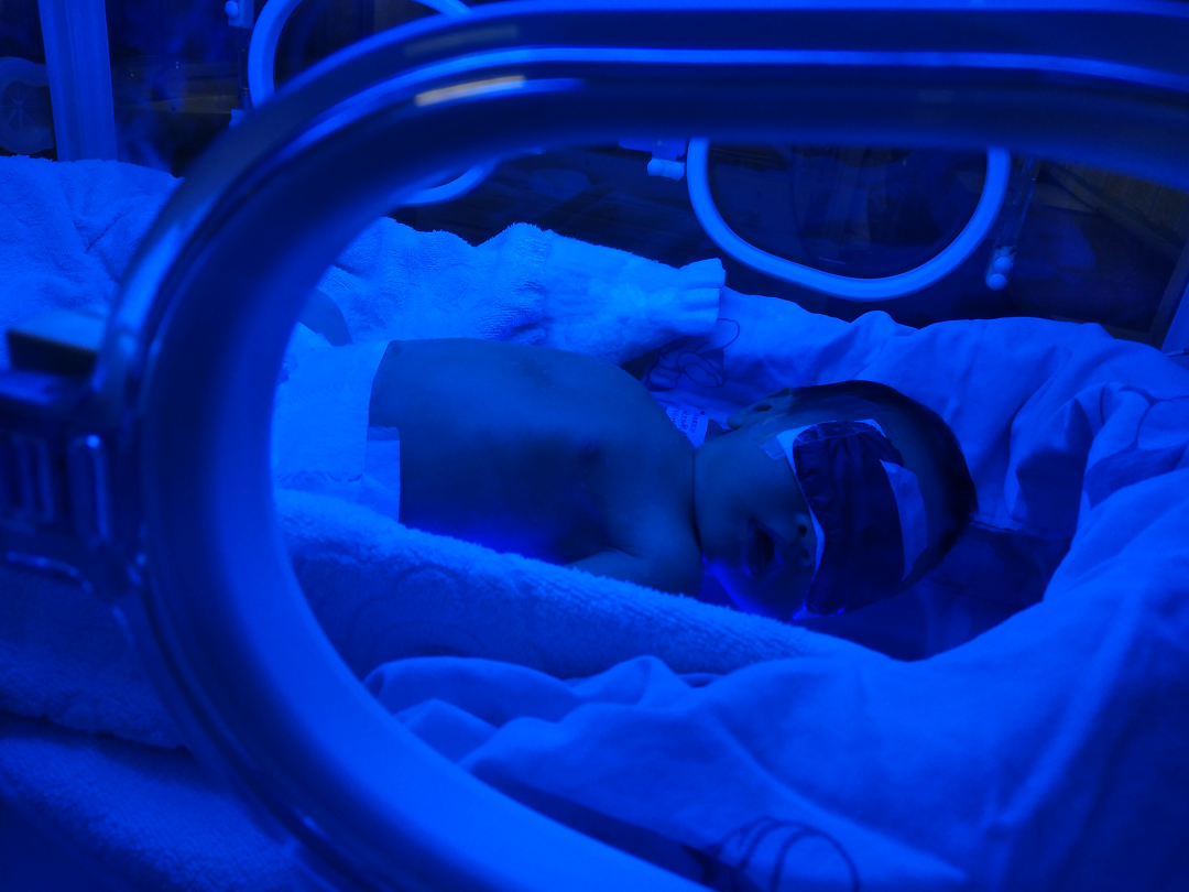 4006B光疗怎么用好消息 ｜ “黄疸宝宝”日间光疗来了，晚间母子不用再分离！_https://www.jmylbn.com_新闻资讯_第8张