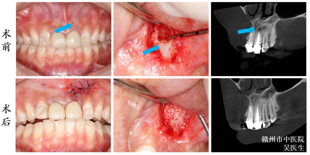 口腔ct怎么拍摄口腔CT —揭秘口腔健康的“透视镜”_https://www.jmylbn.com_新闻资讯_第10张