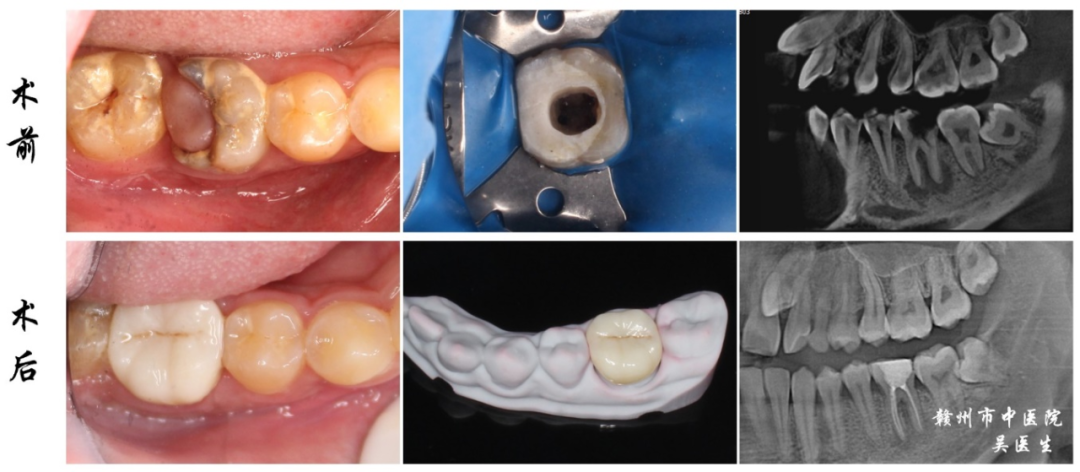 口腔ct怎么拍摄口腔CT —揭秘口腔健康的“透视镜”_https://www.jmylbn.com_新闻资讯_第21张