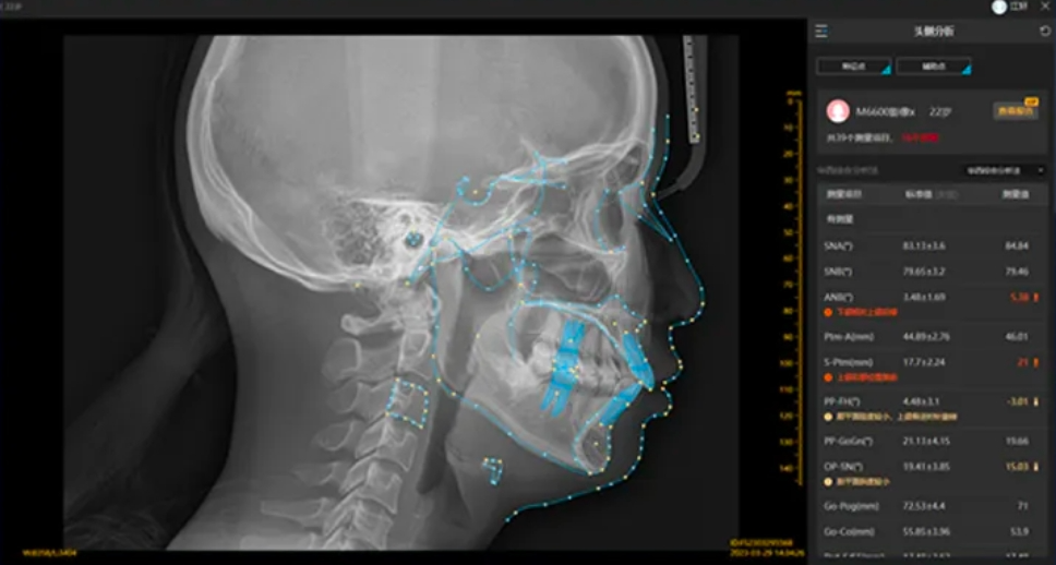 口腔ct怎么拍摄口腔CT —揭秘口腔健康的“透视镜”_https://www.jmylbn.com_新闻资讯_第16张
