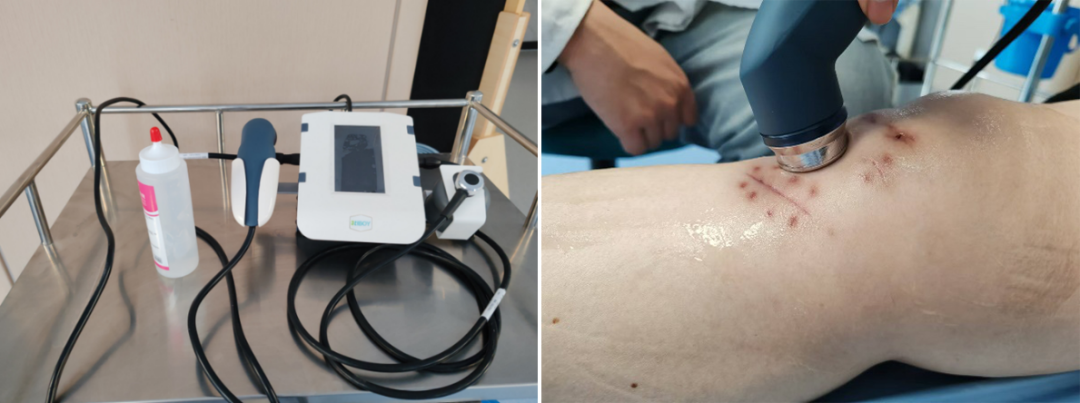 什么是理疗仪康复科那些神奇的理疗仪_https://www.jmylbn.com_新闻资讯_第11张