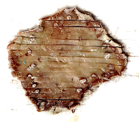 什么是260胃镜医视点 ｜ 精细胃镜使内镜进入“显微时代”_https://www.jmylbn.com_新闻资讯_第10张