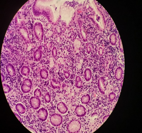 什么是260胃镜医视点 ｜ 精细胃镜使内镜进入“显微时代”_https://www.jmylbn.com_新闻资讯_第11张