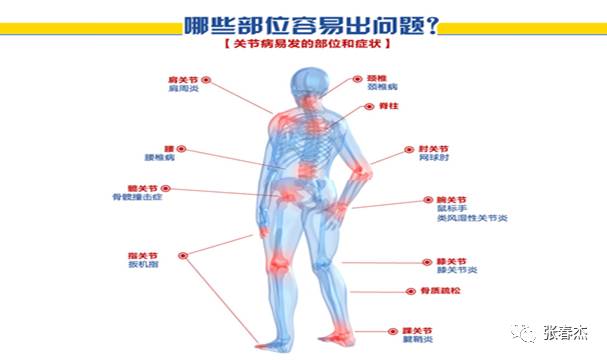 视频 有氨糖 硫酸软骨素 胶原蛋白和钙 组成的 天狮飒敏胶囊 帮你从根本上修复骨关节疾病 痛在关节 根在软骨 张春杰 微信公众号文章阅读