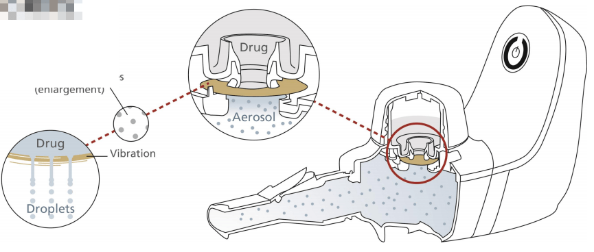 BD雾化器怎么样不同类型雾化器的区别在哪？_https://www.jmylbn.com_新闻资讯_第4张