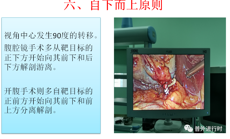 为什么负压引流每周一学、颇有收获--- 腹腔镜手术的十项基本原则、封闭持续负压吸引（VSD）护理_https://www.jmylbn.com_新闻资讯_第9张