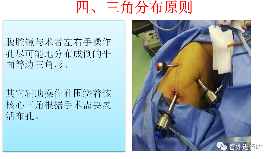 为什么负压引流每周一学、颇有收获--- 腹腔镜手术的十项基本原则、封闭持续负压吸引（VSD）护理_https://www.jmylbn.com_新闻资讯_第7张