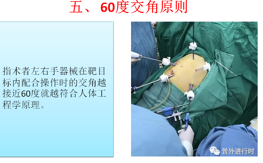 为什么负压引流每周一学、颇有收获--- 腹腔镜手术的十项基本原则、封闭持续负压吸引（VSD）护理_https://www.jmylbn.com_新闻资讯_第8张