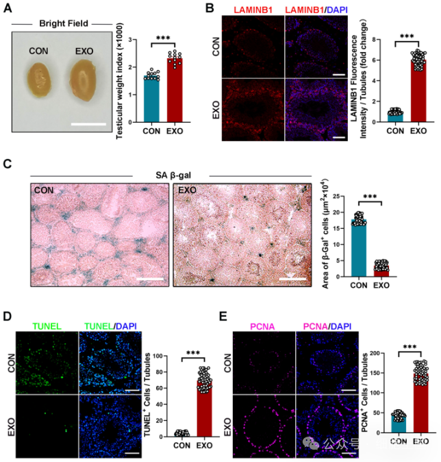 001).免疫荧光和sa-β-gal染色显示, humsc-exos注射显着增加(p 0.