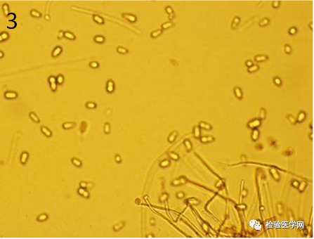 大便真菌孢子图片图片