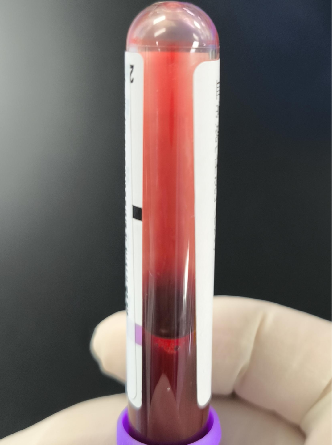 血常规用什么仪器检测秋冬血常规“陷阱”规避：冷凝集与脂血标本处理全攻略来了_https://www.jmylbn.com_新闻资讯_第4张