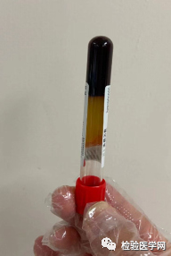 「无添加剂的红头真空采血管」采血后需要颠倒混匀吗?