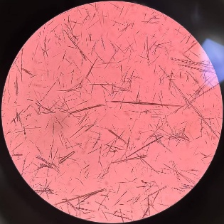 尿沉渣仪器怎么使用“你是谁”？被尿沉渣仪器错过的神秘结晶_https://www.jmylbn.com_新闻资讯_第4张