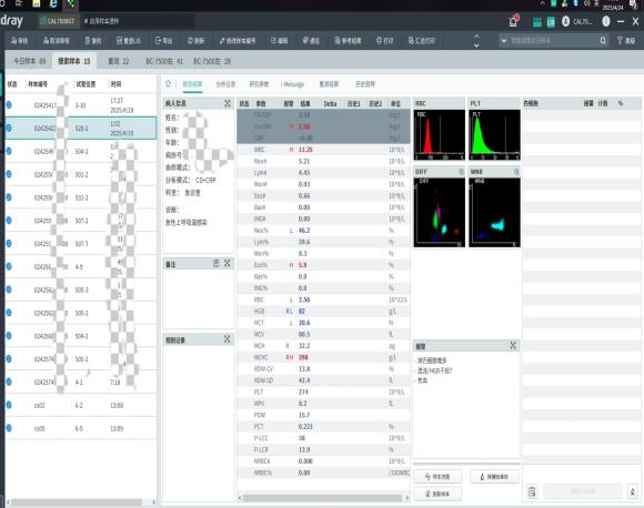 HGB故障怎么处理血常规参数矛盾的贫血假象，竟是因电磁阀故障_https://www.jmylbn.com_新闻资讯_第5张