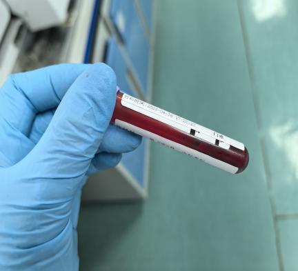 HGB故障怎么处理血常规参数矛盾的贫血假象，竟是因电磁阀故障_https://www.jmylbn.com_新闻资讯_第7张