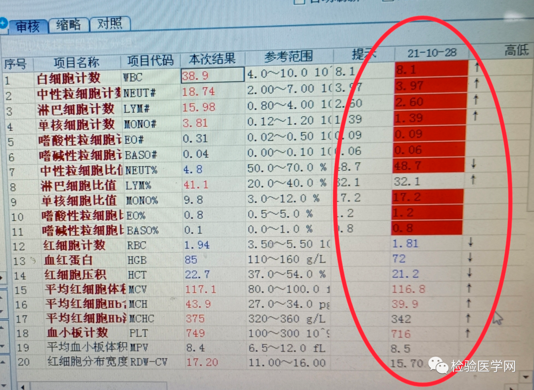 血常规用什么仪器检查同厂家仪器两次血常规结果相差巨大，原因值得所有检验人警惕！_https://www.jmylbn.com_新闻资讯_第3张