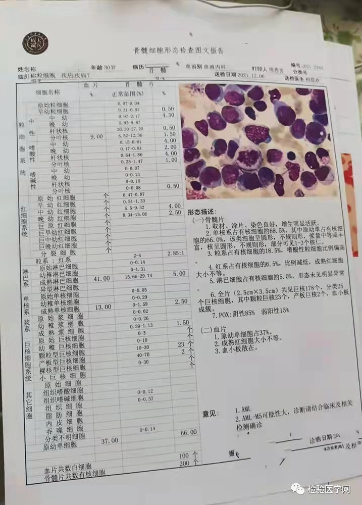 一例急性单核细胞白血病引发的思考_医学界-助力医生临床决策和职业