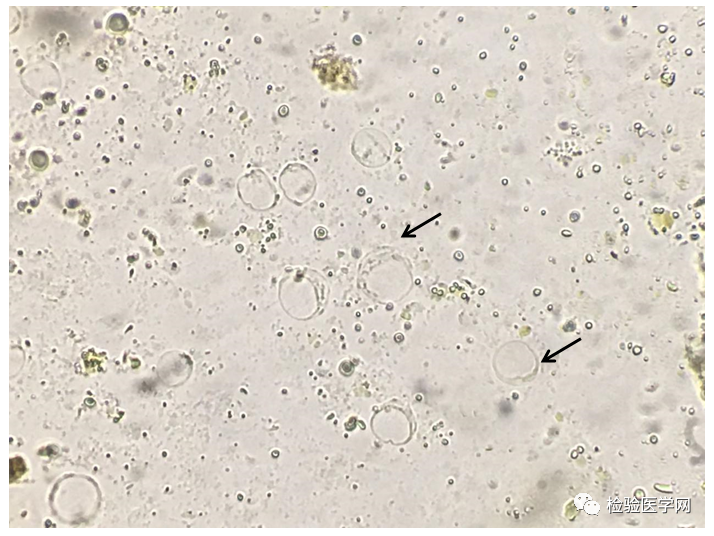 人芽囊原虫你了解多少?