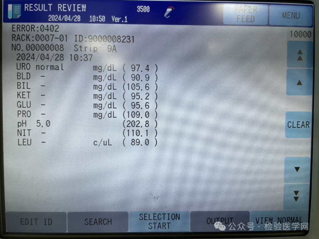 医院尿检仪器怎么卖又现“茶尿”送检事件？检验科究竟有没有权威“尿检”能力_https://www.jmylbn.com_新闻资讯_第5张