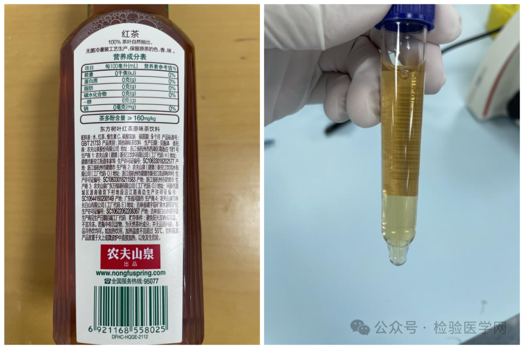 医院尿检仪器怎么卖又现“茶尿”送检事件？检验科究竟有没有权威“尿检”能力_https://www.jmylbn.com_新闻资讯_第4张