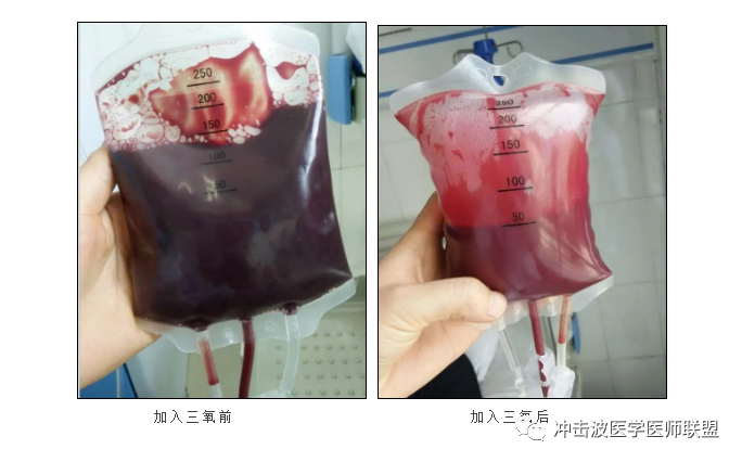 三氧疗法怎么代理三氧自血疗法可预防疾病、“治未病”，为亚健康人群提供健康调理保健！_https://www.jmylbn.com_新闻资讯_第3张