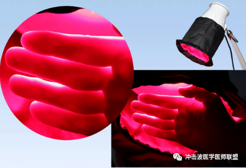 红光怎么治疗什么是红光疗法？红光疗法是如何运作的？红光疗法有什么好处？_https://www.jmylbn.com_新闻资讯_第1张