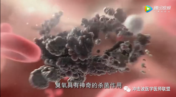 医用臭氧有什么作用臭氧疗法不仅是目前所知的最安全的医用方法，而且没有副作用!_https://www.jmylbn.com_新闻资讯_第1张