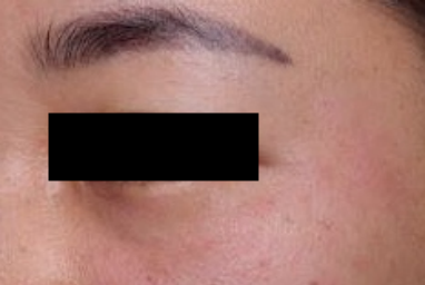 什么是医用透明质酸钠【医学美容】关于透明质酸钠复合溶液（嗨体），你知道吗？_https://www.jmylbn.com_新闻资讯_第16张