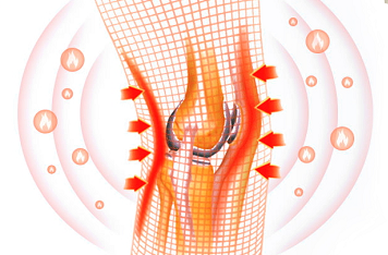 理疗热敷贴怎么贴这个东西是老寒腿克星！每天坚持能让腿脚年轻20岁！_https://www.jmylbn.com_新闻资讯_第29张