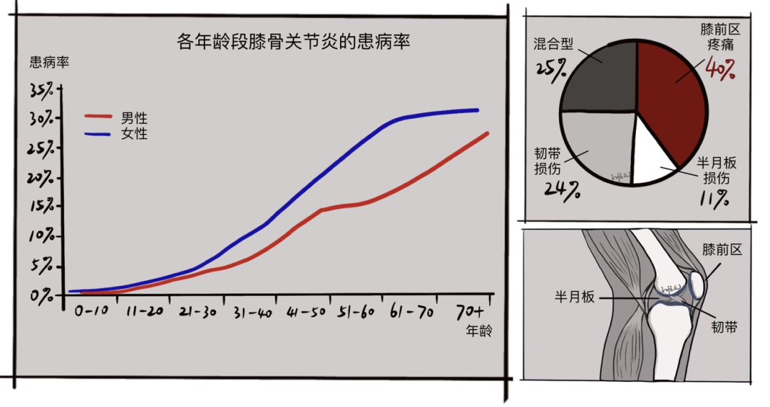 理疗热敷贴怎么贴这个东西是老寒腿克星！每天坚持能让腿脚年轻20岁！_https://www.jmylbn.com_新闻资讯_第3张