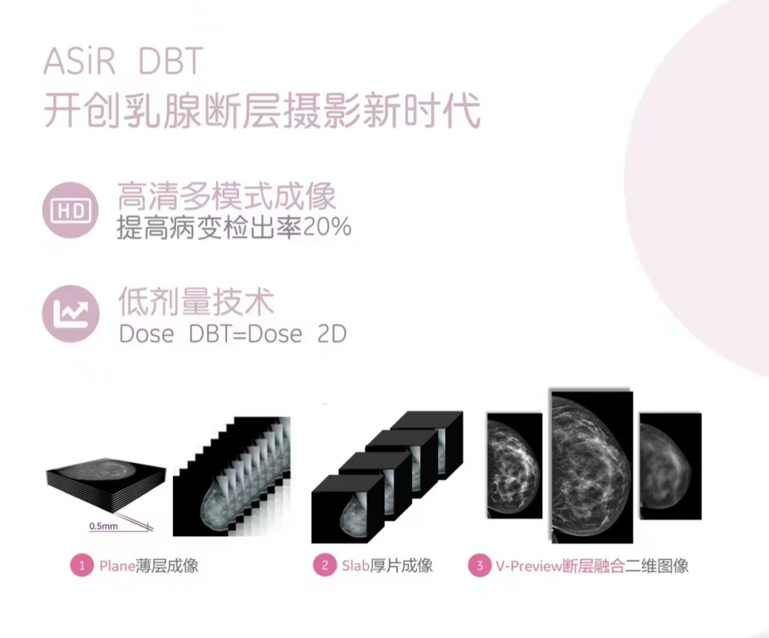 ge钼靶机怎么打印【关爱女性健康】乳腺癌筛查利器——乳腺钼靶检查_https://www.jmylbn.com_新闻资讯_第3张