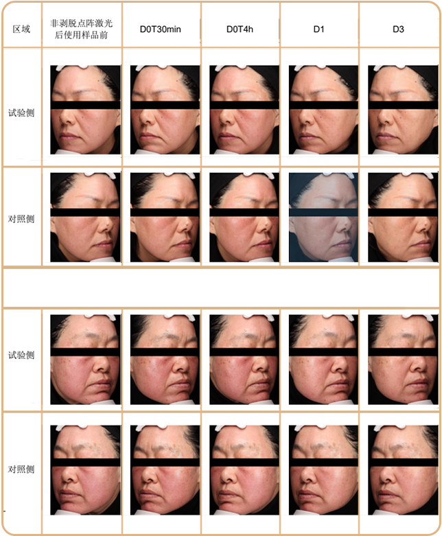 绽媄娅的产品怎么样比买包爽100倍！糕妈的“医美平替”太绝了！素颜年轻5岁，连老公都夸认不出_https://www.jmylbn.com_新闻资讯_第40张