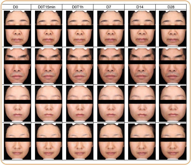 绽媄娅的产品怎么样比买包爽100倍！糕妈真香的“医美平替”，素颜照太惊艳了！年轻好几岁_https://www.jmylbn.com_新闻资讯_第33张