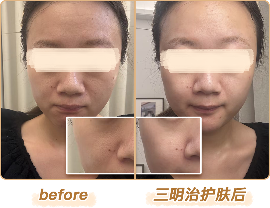 绽媄娅的产品怎么样比买包爽100倍！糕妈真香的“医美平替”，素颜照太惊艳了！年轻好几岁_https://www.jmylbn.com_新闻资讯_第20张