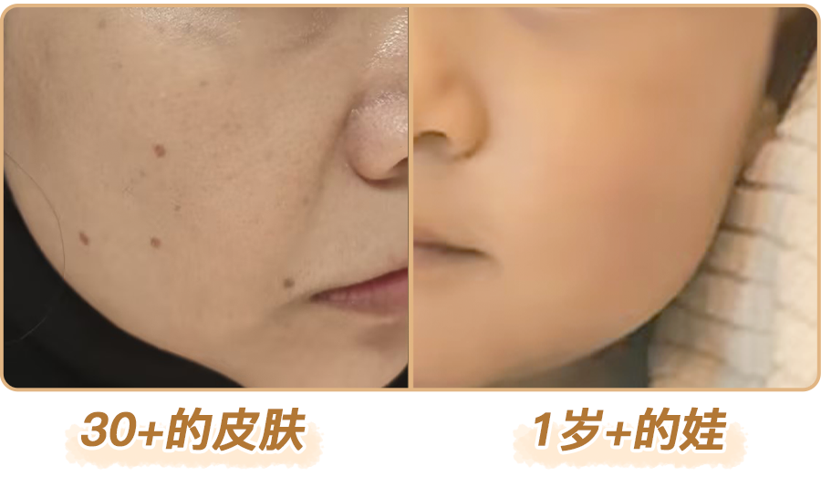 绽媄娅的产品怎么样比买包爽100倍！糕妈的“医美平替”太绝了！素颜年轻5岁，连老公都夸认不出_https://www.jmylbn.com_新闻资讯_第22张