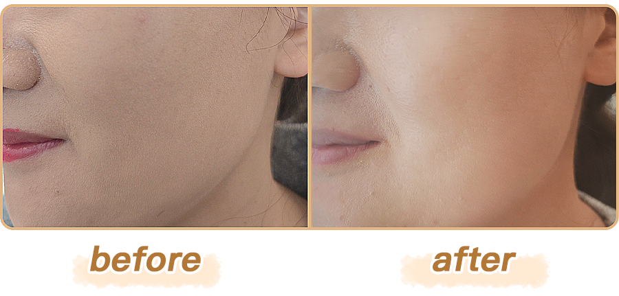 绽媄娅的产品怎么样比买包爽100倍！糕妈真香的“医美平替”，素颜照太惊艳了！年轻好几岁_https://www.jmylbn.com_新闻资讯_第21张