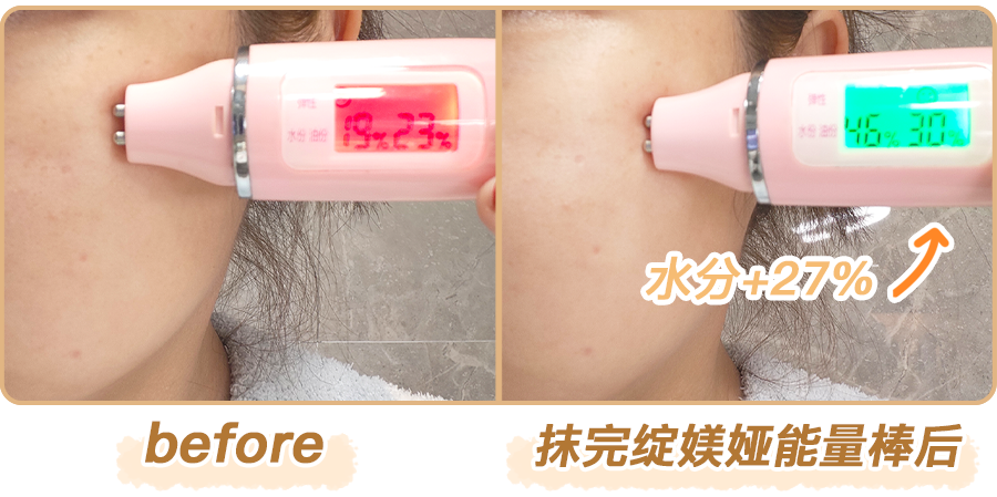 绽媄娅的产品怎么样比买包爽100倍！糕妈真香的“医美平替”，素颜照太惊艳了！年轻好几岁_https://www.jmylbn.com_新闻资讯_第50张