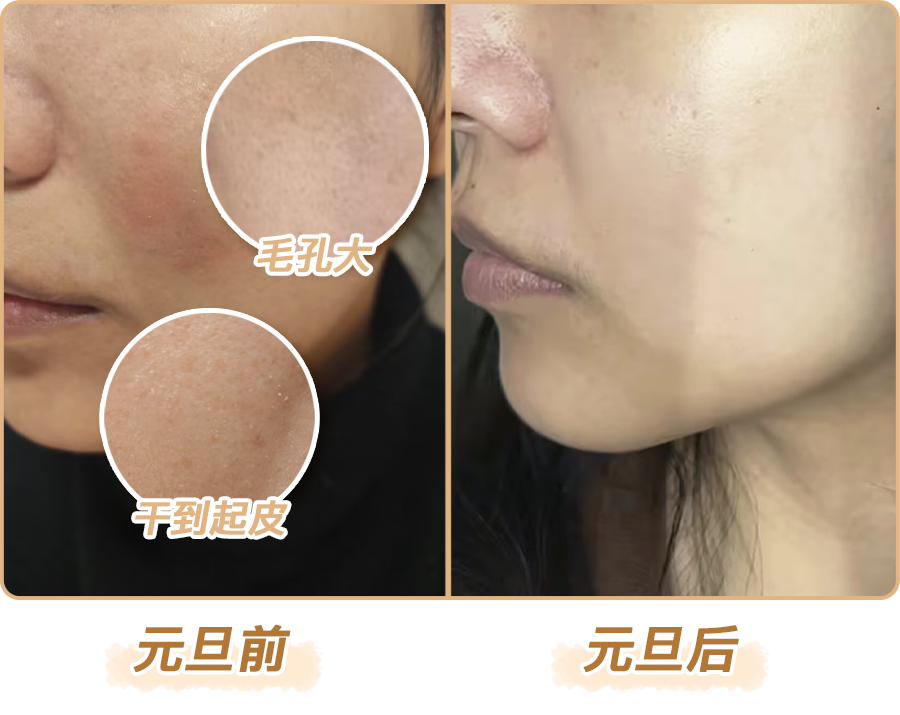 绽媄娅的产品怎么样比买包爽100倍！糕妈真香的“医美平替”，素颜照太惊艳了！年轻好几岁_https://www.jmylbn.com_新闻资讯_第2张