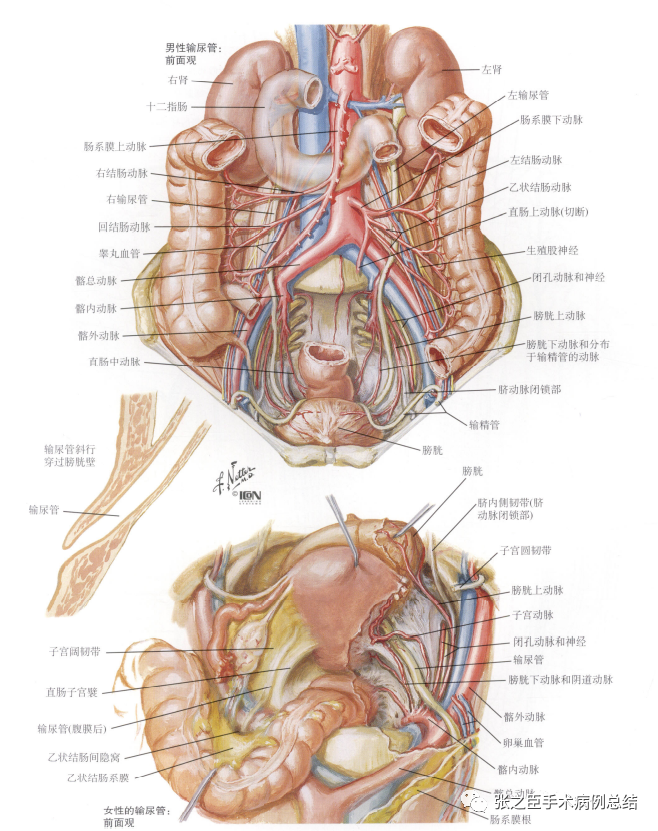 泌尿导丝怎么收费泌尿系结石治疗系列2——经尿道输尿管硬镜碎石取石术_https://www.jmylbn.com_新闻资讯_第2张